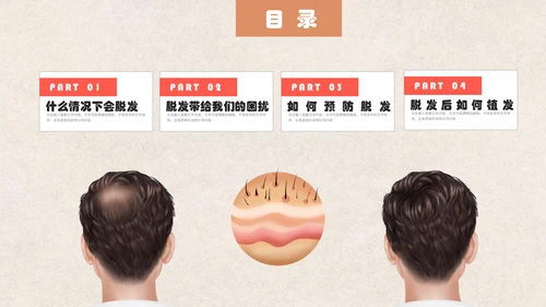 医疗健康预防脱发教学讲座通用PPT课件