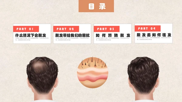 医疗健康预防脱发教学讲座通用PPT课件