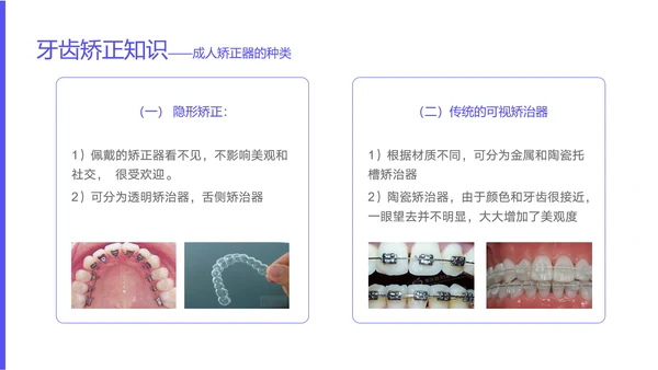 中青年口腔卫生牙料知识宣教PPT模板