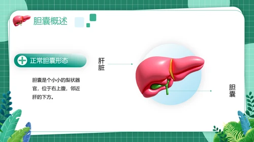 胆囊结石健康管理PPT模板