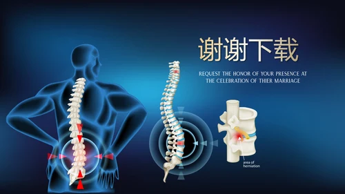 蓝色医疗颈椎病的护理动态PPT