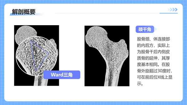 蓝色插画风股骨颈骨医护人员培训讲座医学护理PPT