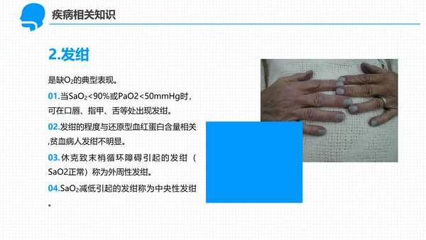 呼吸科护理查房PPT课件（呼吸衰竭）
