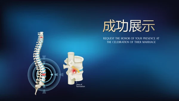 蓝色医疗颈椎病的护理动态PPT