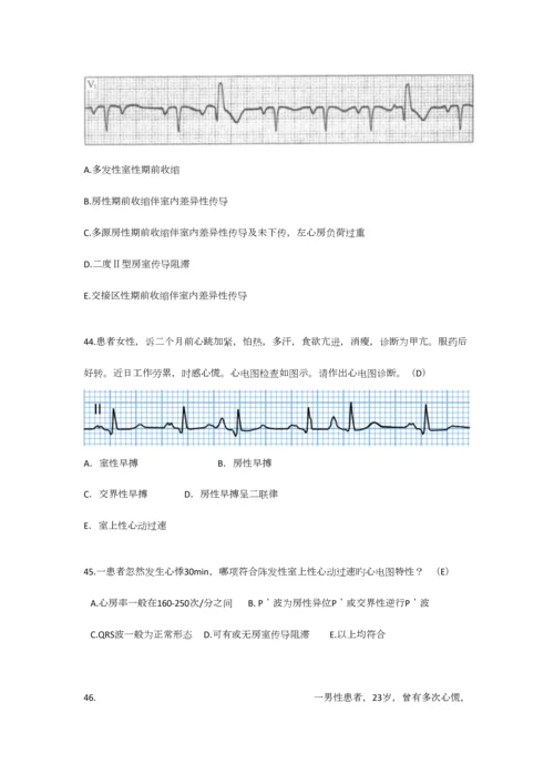 2023年规培心电图题库.docx