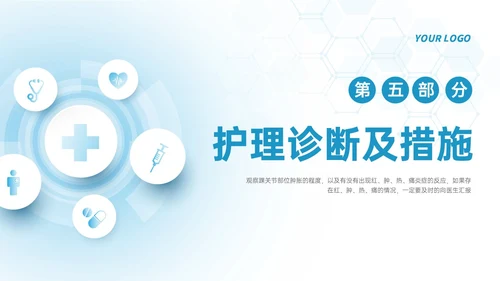 蓝色简约形状踝骨骨折护理查房医护培训ppt