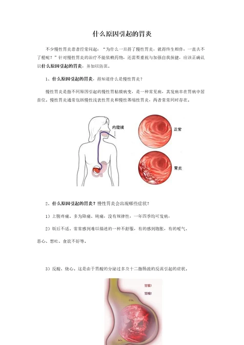 什么原因引起的胃炎