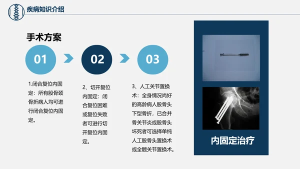 股骨颈骨折术后护理查房培训教学PPT课件
