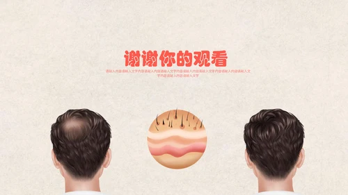 医疗健康预防脱发教学讲座通用PPT课件