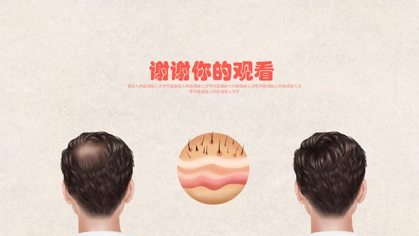医疗健康预防脱发教学讲座通用PPT课件