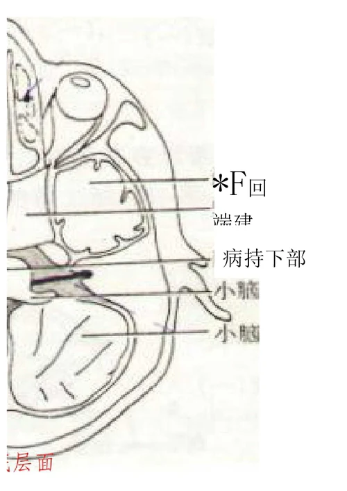 中枢神经系统断层影像