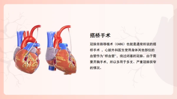 冠心病心血管科健康教育，心脏病通用PPT模板