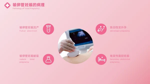 粉色实拍风异位妊娠的诊治医疗健康母婴孕妇培训PPT