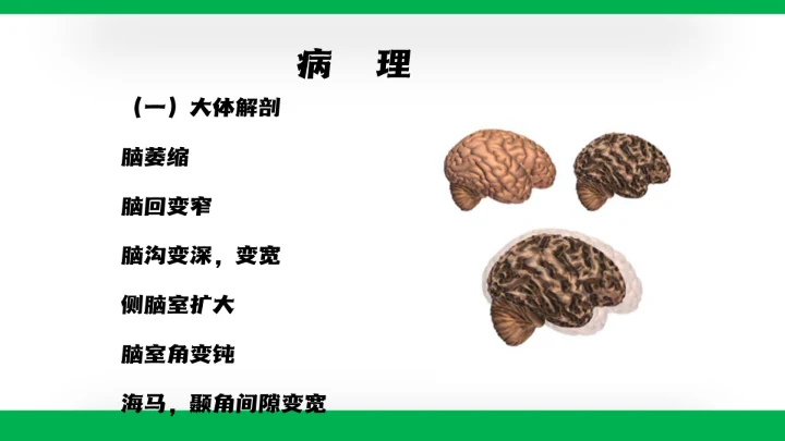 脑病科大脑疾病阿尔茨海默病通用PPT模板