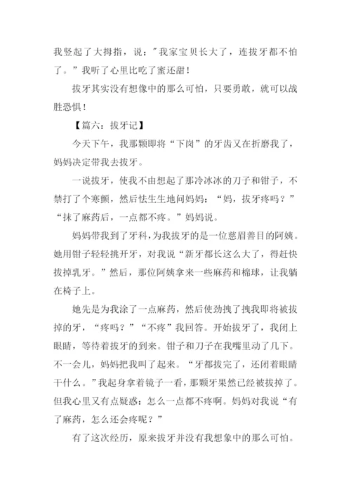 小学生作文拔牙记.docx