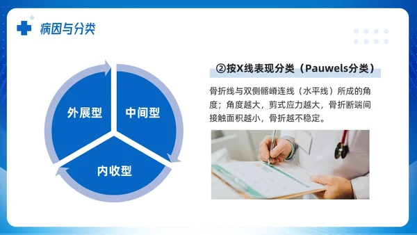 蓝色简约股骨颈骨折课件PPT模板宣传PPT动态PPT