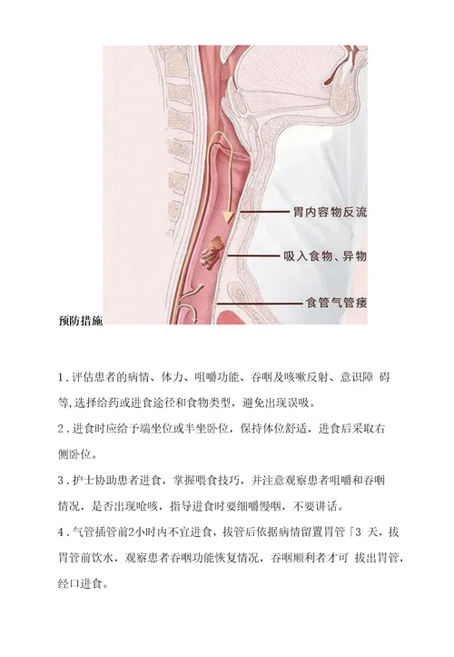 患者发生误吸时的应急预案