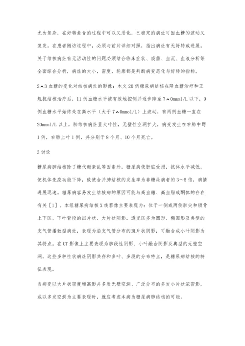 糖尿病合并肺结核20例影像学诊断.docx