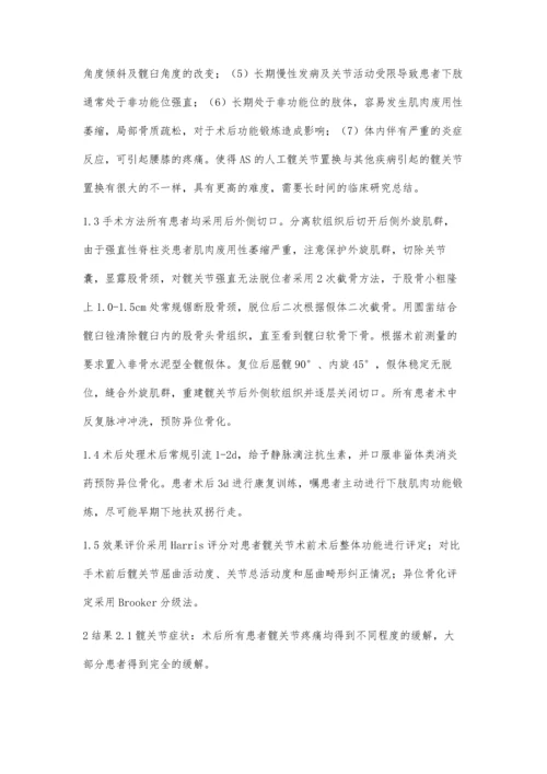 强直性脊柱炎累及双髋关节的THA治疗.docx