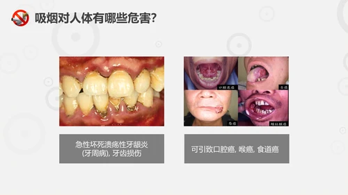 珍爱生命远离香烟世界无烟日通用PPT