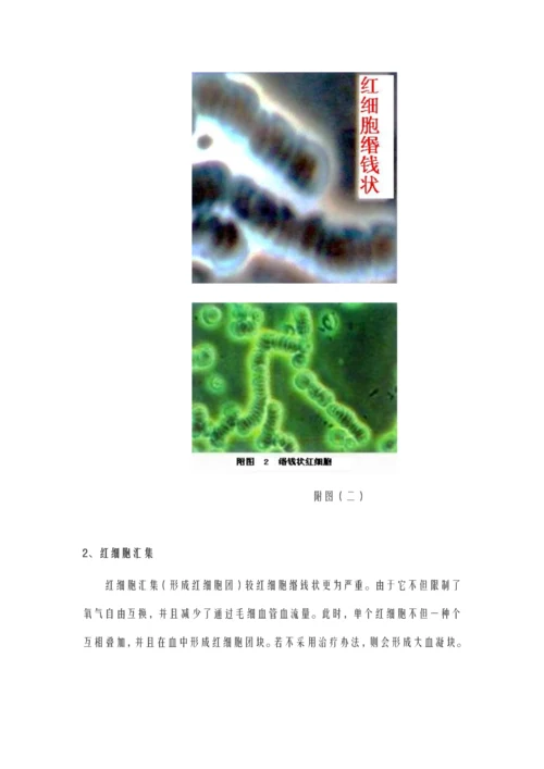 一滴血学习重点笔记.docx