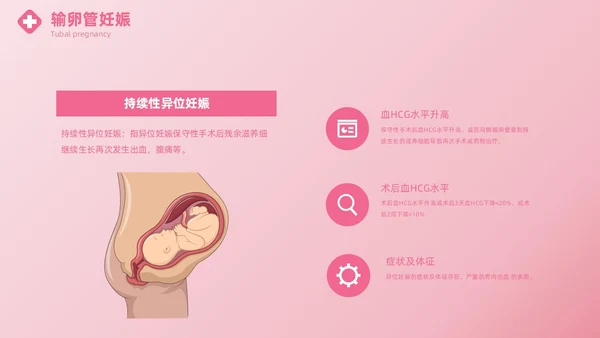 粉色实拍风异位妊娠的诊治医疗健康母婴孕妇培训PPT