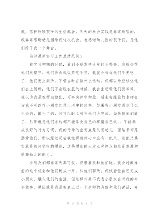 幼师通用实习工作总结范例大全.docx
