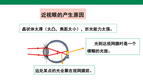 人教版第五章透镜及其应用第4节眼睛和眼镜 课件 (共23张PPT)