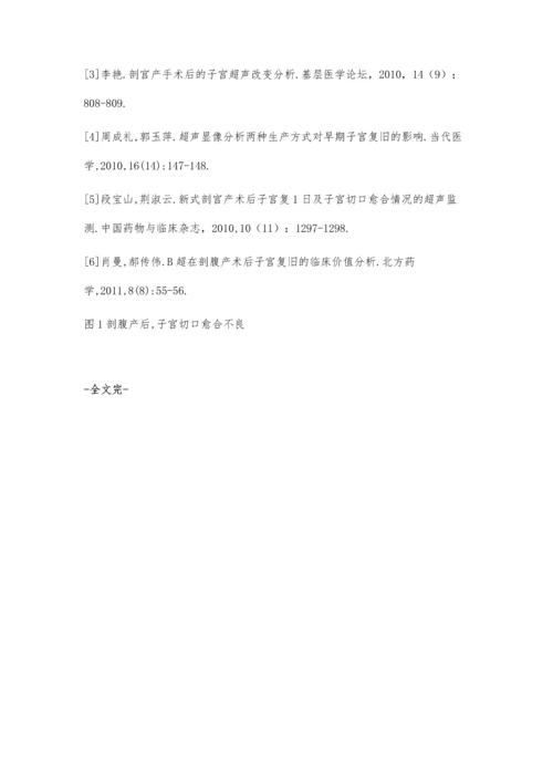 新型剖宫产技术后超声对子宫复旧诊断的意义王宏婵魏立亚.docx