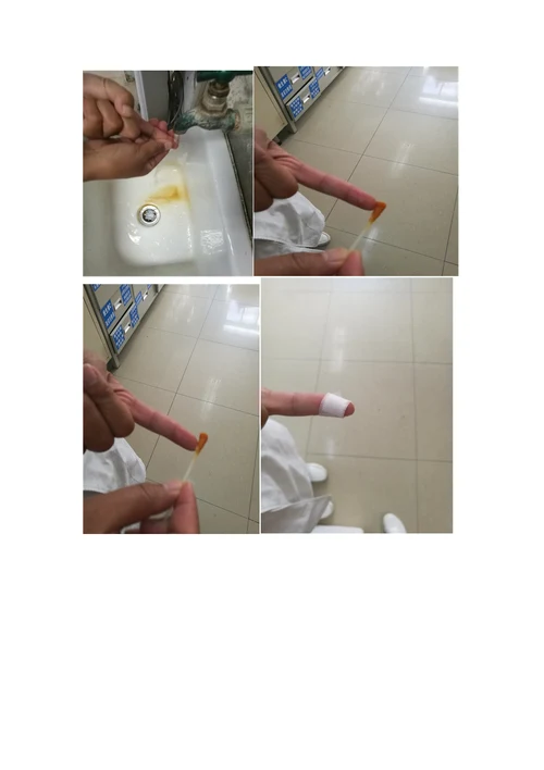 发生针刺伤应急预案