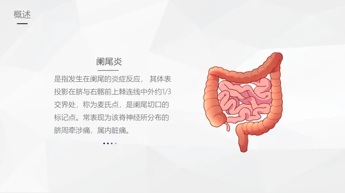 阑尾炎手术术后护理查房通用PPT模板