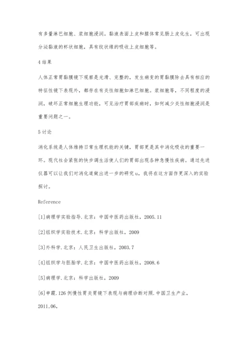 正常胃黏膜和病变胃粘膜的镜下比较.docx