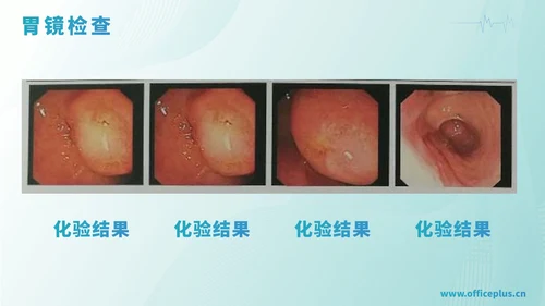 绿色渐变医学病例汇报PPT模板