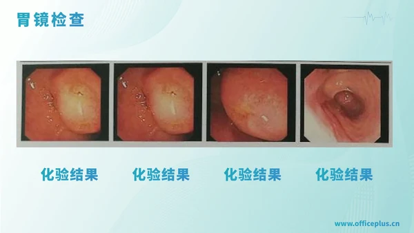 绿色渐变医学病例汇报PPT模板