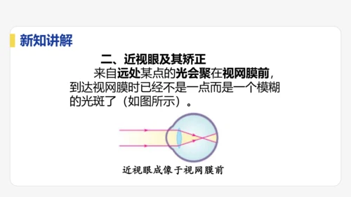 5.4  眼睛与眼镜  课件