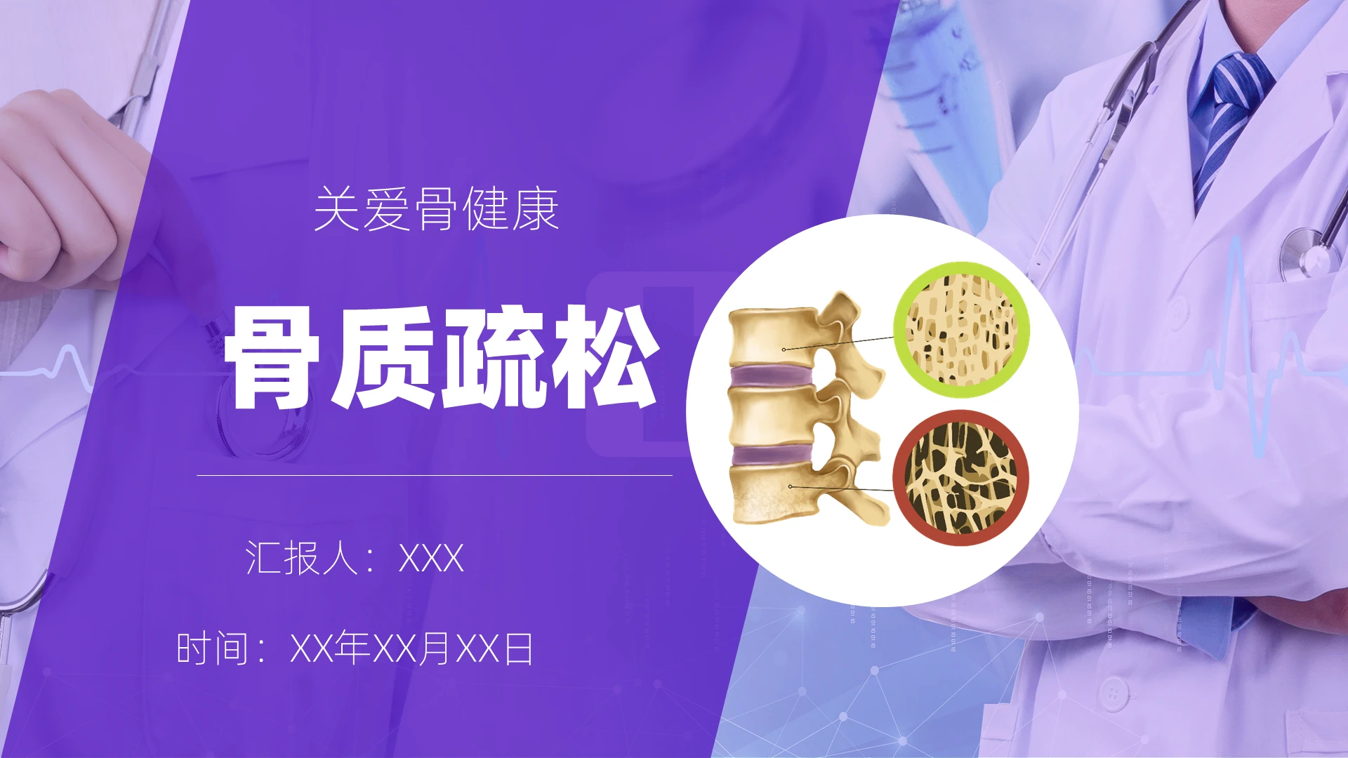 蓝白色简约骨质疏松医疗汇报健康知识培训PPT