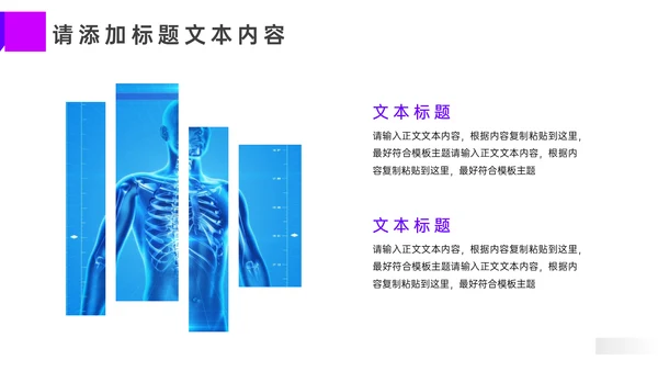 医疗术后护理方案汇报通用PPT模板
