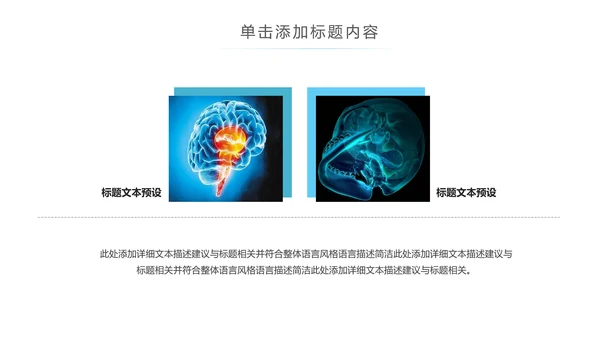 精美大气医学医疗大脑研究报告动态ppt模板