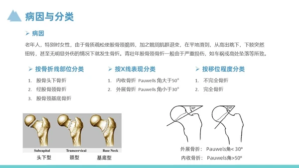 蓝色简约风股骨颈骨折护理查房培训课件