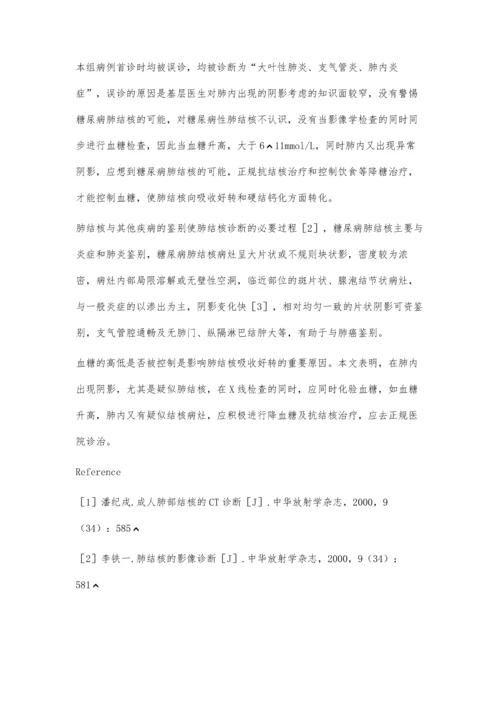 糖尿病合并肺结核20例影像学诊断.docx