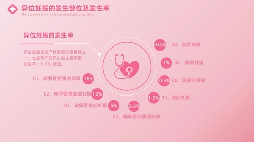 粉色实拍风异位妊娠的诊治医疗健康母婴孕妇培训PPT