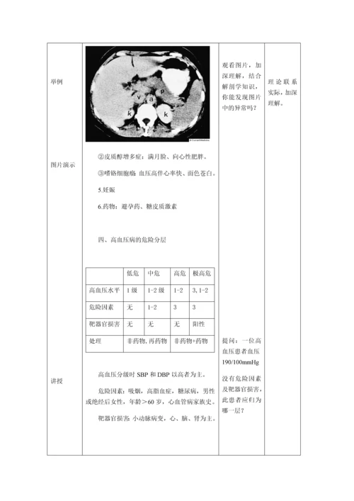 高血压病教案.docx