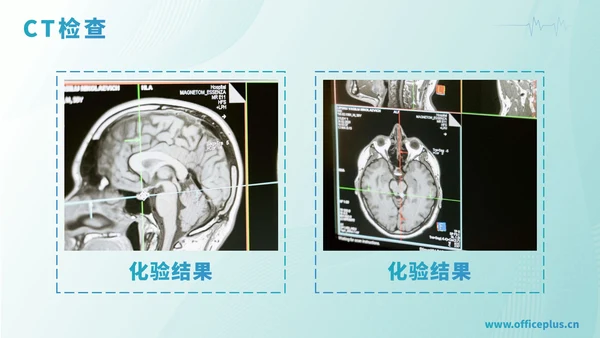 绿色渐变医学病例汇报PPT模板