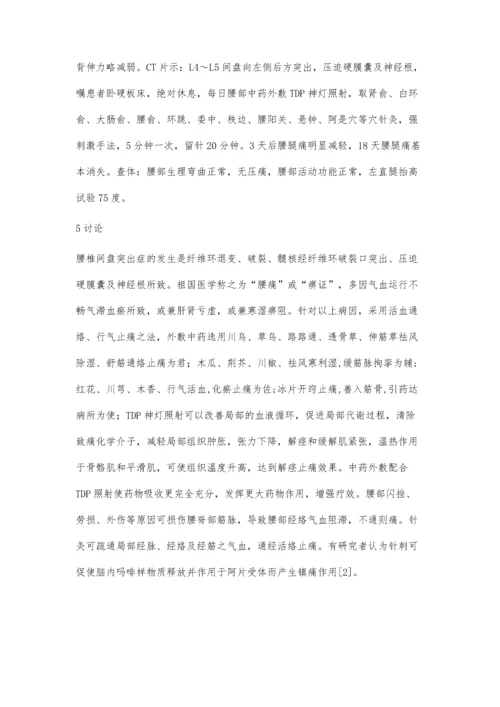 TDP神灯中药熏药配合针灸治疗腰椎间盘突出症246例.docx