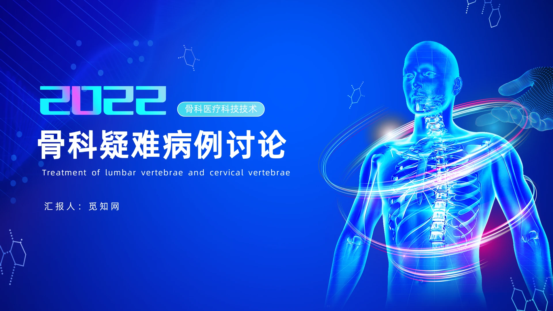 蓝色简约风骨科疑难病例讨论培训PPT