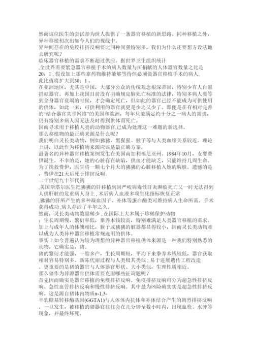 【精编】器官移植论文精选.docx