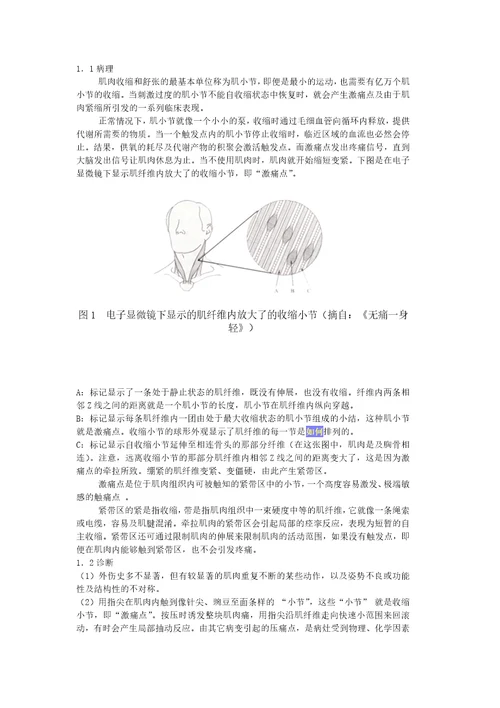 肌筋膜疼痛综合征诊断与治疗研究进展