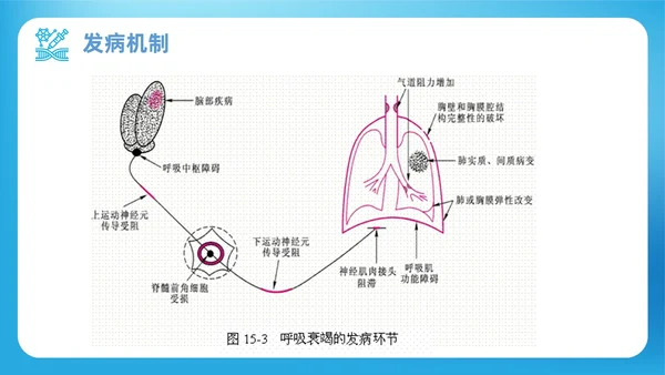 蓝色渐变简约商务呼吸衰竭病人护理查房医疗护理培训PPT