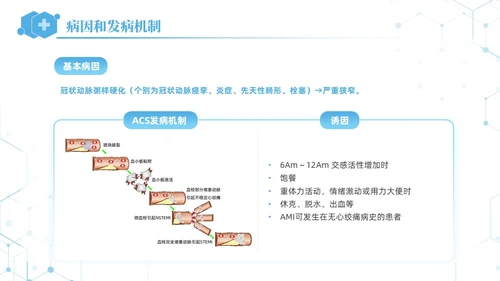 蓝色简约急性心肌梗死培训课件PPT模板