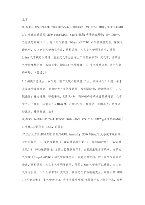 以反复喘息为表现的支气管桥畸形3例病例分析.docx